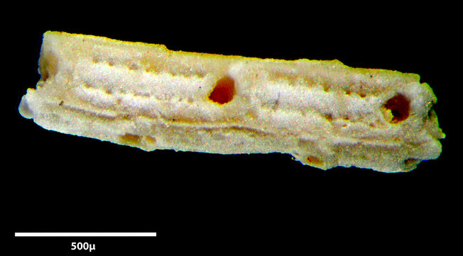 Senckenberg, Bryozoa, Bryozoen, Moostierchen, Sammlung Voigt