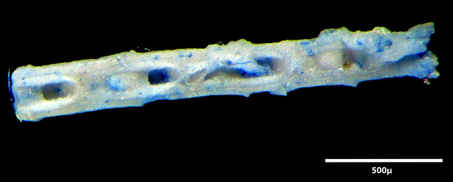 Senckenberg, Bryozoa, Bryozoen, Moostierchen, Sammlung Voigt