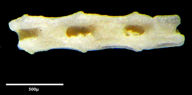 Senckenberg, Bryozoa, Bryozoen, Moostierchen, Sammlung Voigt
