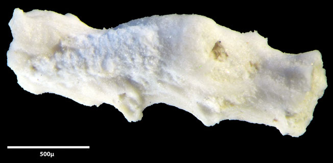 Senckenberg, Bryozoa, Bryozoen, Moostierchen, Sammlung Voigt