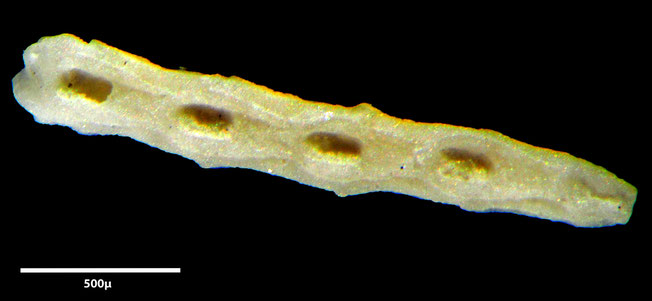 Senckenberg, Bryozoa, Bryozoen, Moostierchen, Sammlung Voigt