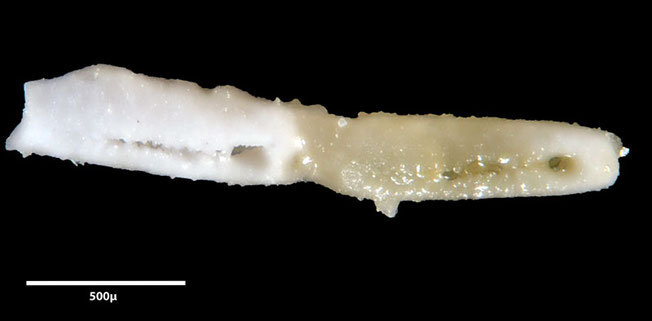 Senckenberg, Bryozoa, Bryozoen, Moostierchen, Sammlung Voigt