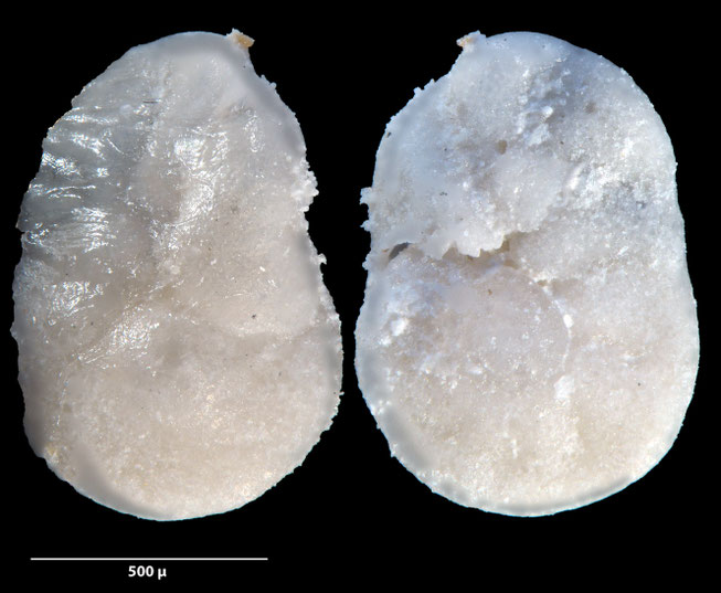 Foraminifere, Foraminifera, Bryozoa, Senckenberg, fossil, Zeltberg, Maastrichtium