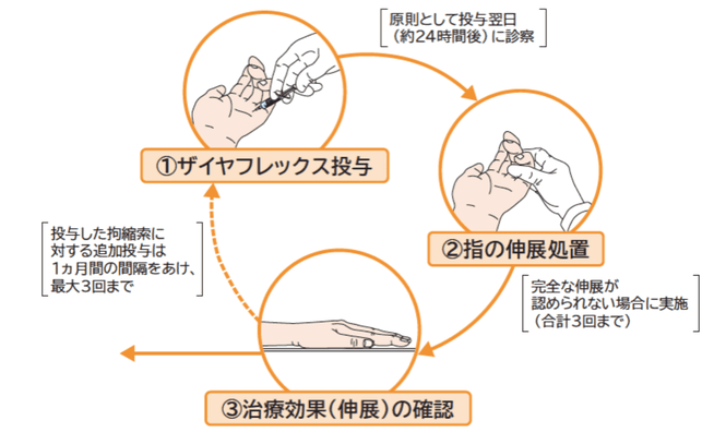 デュピュイトラン拘縮、酵素注射療法、ザイヤフレックス、國府幸洋、千葉県、柏市、名戸ヶ谷病院