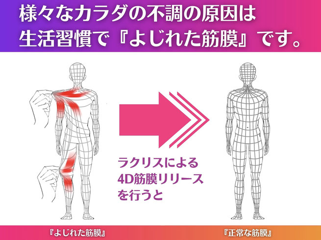 大阪　寝屋川　香里園　筋膜リリース　整体　マッサージ　肩こり　腰痛　頭痛