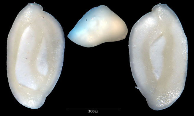 Foraminiferen, Foraminifera, Foras, Mikroskop, Senckenberg, Mittelmeer, Cibicidoides, Cyclocibicides, Elphidium, Pseudotriloculina, Quinqueloculina