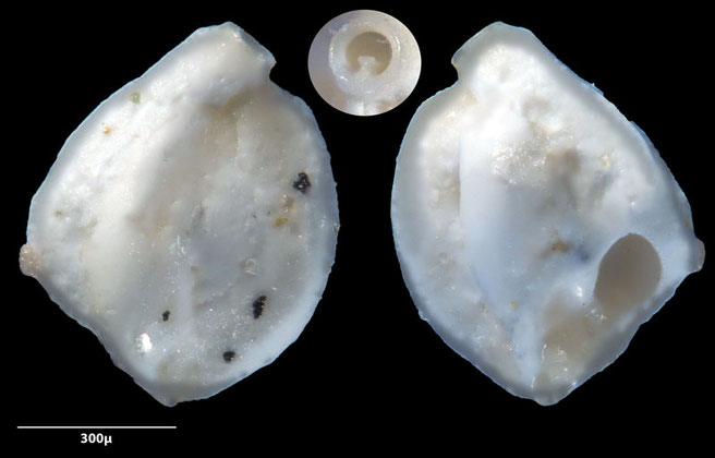 Foraminiferen, Foraminifera, Foras, Mikroskop, Senckenberg, Mittelmeer, Cibicidoides, Cyclocibicides, Elphidium, Pseudotriloculina, Quinqueloculina