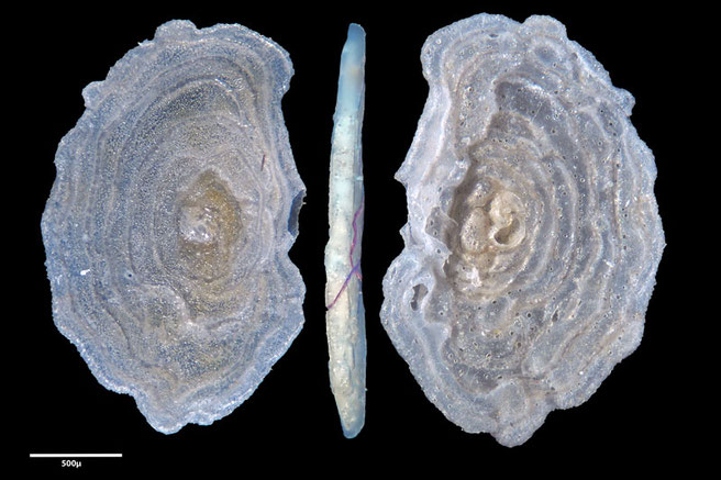 Foraminiferen, Foraminifera, Foras, Mikroskop, Senckenberg, Mittelmeer, Cibicidoides, Cyclocibicides 