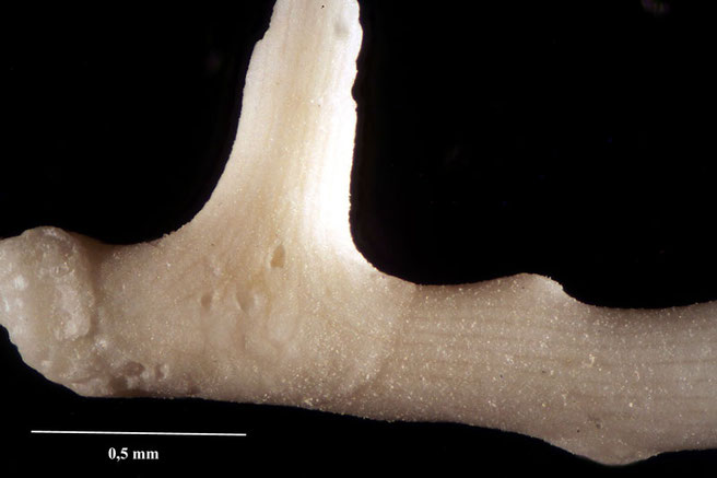 Senckenberg, Bryozoa, Bryozoen, Moostierchen, Sammlung Voigt