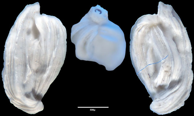 Foraminiferen, Foraminifera, Foras, Mikroskop, Senckenberg, Mittelmeer, Cibicidoides, Cyclocibicides, Elphidium, Pseudotriloculina