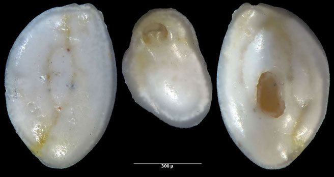 Foraminiferen, Foraminifera, Foras, Mikroskop, Senckenberg, Mittelmeer, Cibicidoides, Cyclocibicides, Elphidium, Pseudotriloculina, Quinqueloculina