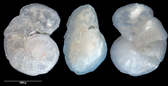 Foraminiferen, Foraminifera, Foras, Mikroskop, Senckenberg, Mittelmeer, Cibicidoides, 