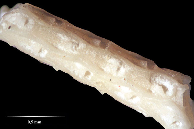 Senckenberg, Bryozoa, Bryozoen, Moostierchen, Sammlung Voigt