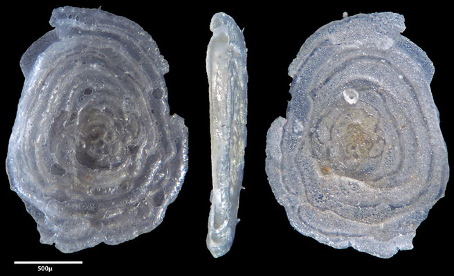 Foraminiferen, Foraminifera, Foras, Mikroskop, Senckenberg, Mittelmeer, Cibicidoides, Cyclocibicides 