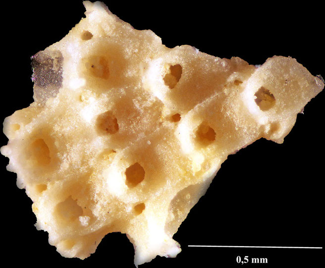 Senckenberg, Bryozoa, Bryozoen, Moostierchen, Sammlung Voigt