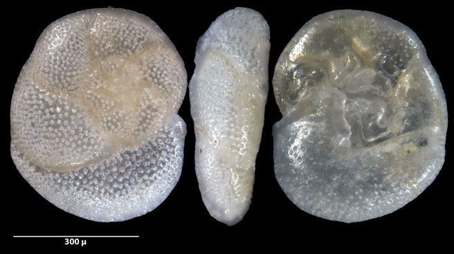 Foraminiferen, Foraminifera, Foras, Mikroskop, Senckenberg, Mittelmeer, Cibicidoides, Cyclocibicides, Elphidium, Pseudotriloculina, Quinqueloculina, Rosalina