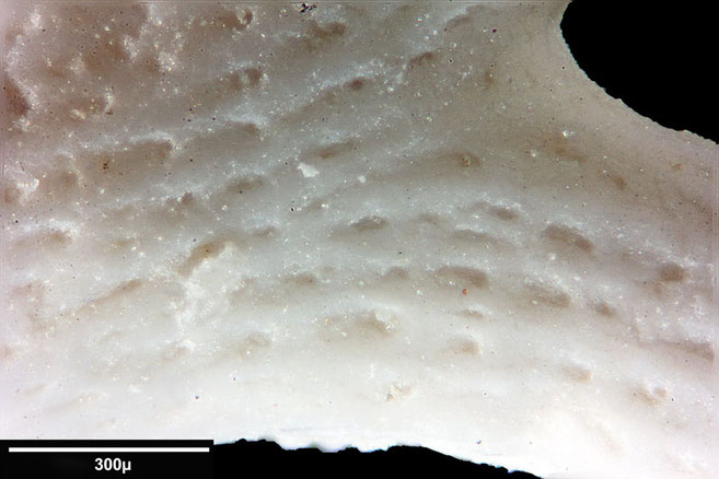Senckenberg, Bryozoa, Bryozoen, Moostierchen, Sammlung Voigt