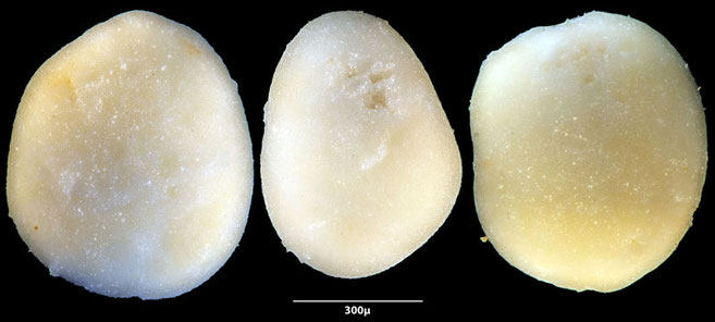Bild 4 Foraminifera sp oder anderes, Grube Curfs aus 38 Aufnahmen gestackt