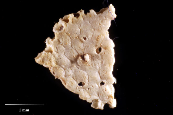 Senckenberg, Bryozoa, Bryozoen, Moostierchen, Sammlung Voigt