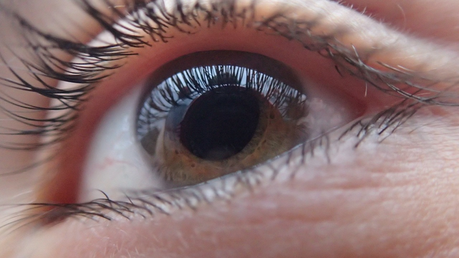 photo showing close up of the eyeball