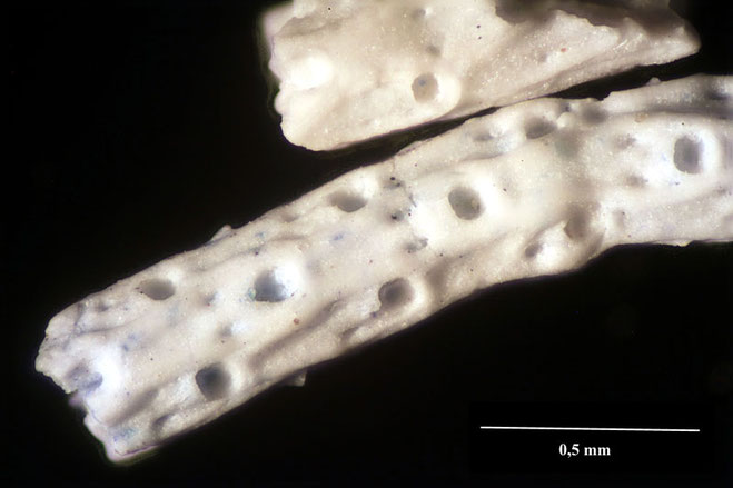 Senckenberg, Bryozoa, Bryozoen, Moostierchen, Sammlung Voigt