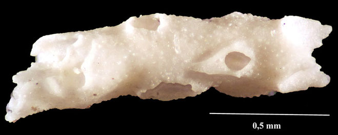 Senckenberg, Bryozoa, Bryozoen, Moostierchen, Sammlung Voigt