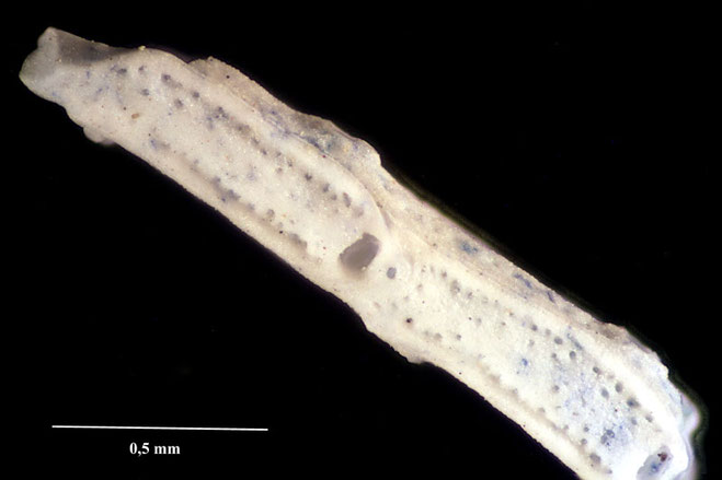 Senckenberg, Bryozoa, Bryozoen, Moostierchen, Sammlung Voigt