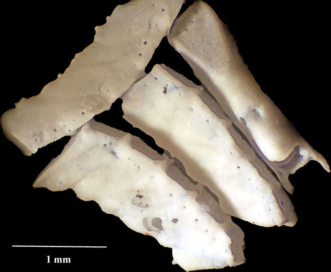 Senckenberg, Bryozoa, Bryozoen, Moostierchen, Sammlung Voigt