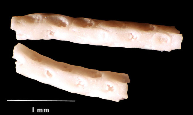 Senckenberg, Bryozoa, Bryozoen, Moostierchen, Sammlung Voigt