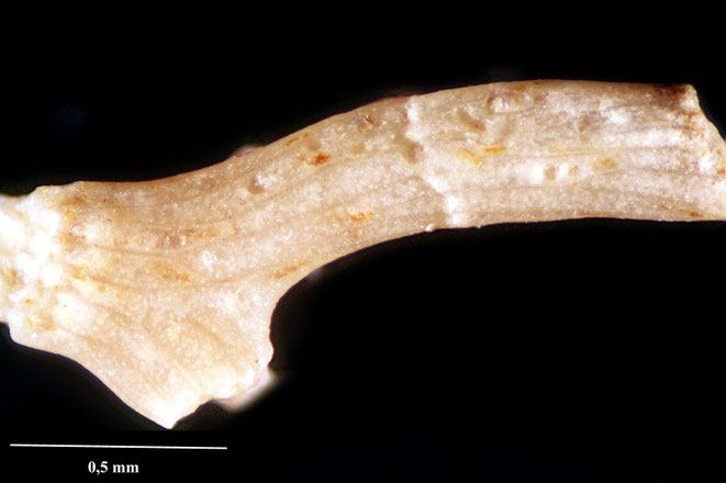 Senckenberg, Bryozoa, Bryozoen, Moostierchen, Sammlung Voigt