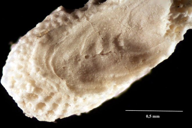 Senckenberg, Bryozoa, Bryozoen, Moostierchen, Sammlung Voigt