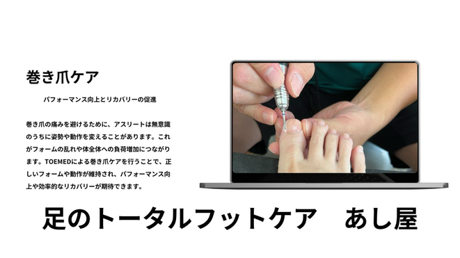 足のトータルフットケアあし屋　巻き爪ケア　TOEMED