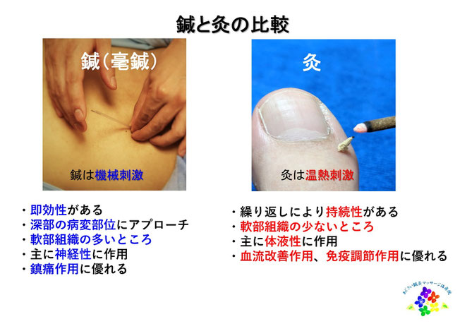 あじさい鍼灸マッサージ治療院　鍼と灸の違い