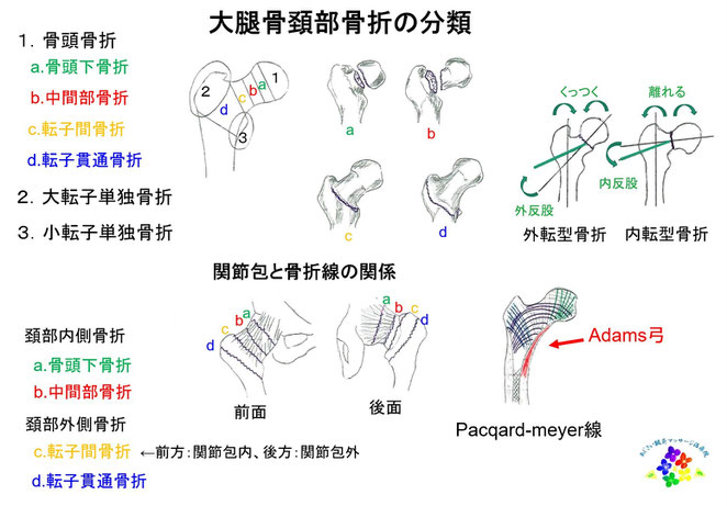 あじさい鍼灸マッサージ治療院　大腿骨頚部骨折