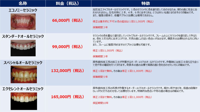 前歯のオールセラミックの料金