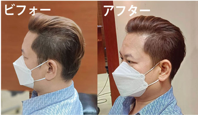 ビフォーアフター