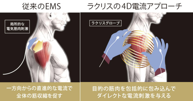 ラクリスグローブから流れる微弱電流で狙った筋肉をもみほぐし、肩こりや腰痛などの原因となっている筋肉にダイレクトに働きかける究極のマッサージ