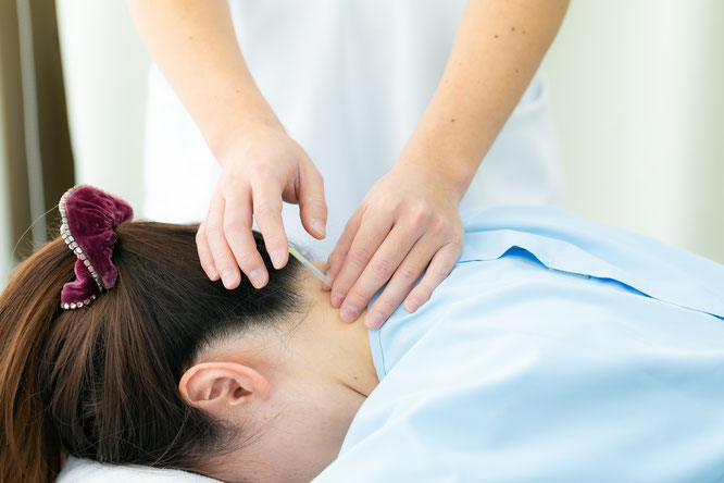 肩こり・頭痛・片頭痛への鍼灸（針灸）治療
