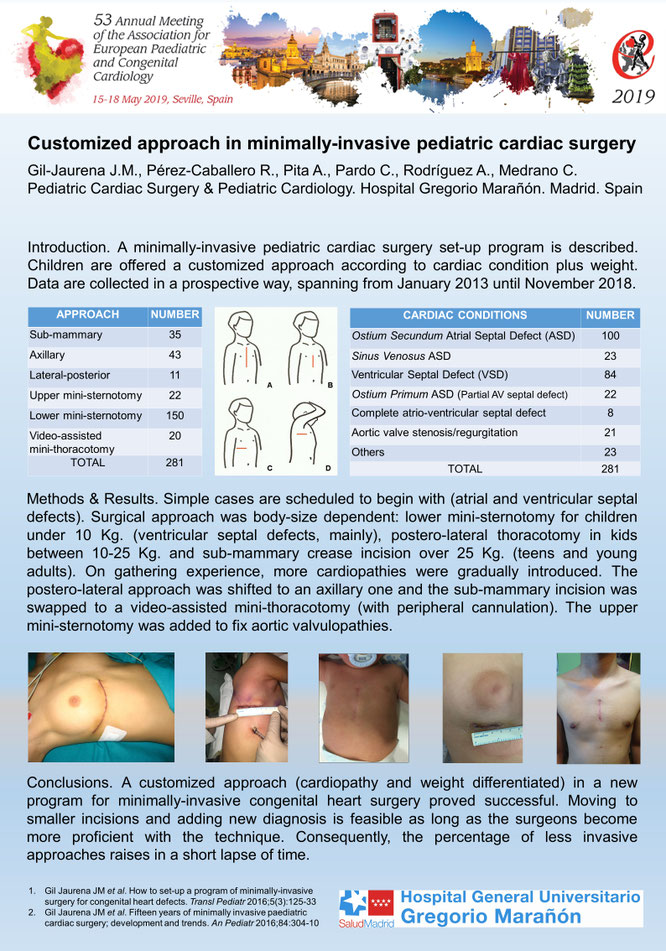 Seguimos creyendo en le cirugía minimante invasiva en niños, como un alternativa segura y que esta para quedarce. 