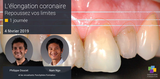 ParoSphère Formation | Formation Elongation coronaire