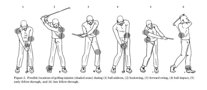 Cabri J et al. Golf-related injuries: A systematic reviewより引用