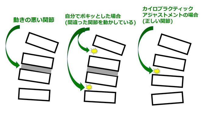 立川市のOUMIスポーツカイロプラクティック｜自分でやる関節ボキボキはあまりおすすめできません