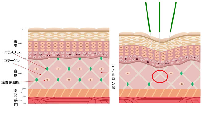 皮膚の構造と鍼刺激