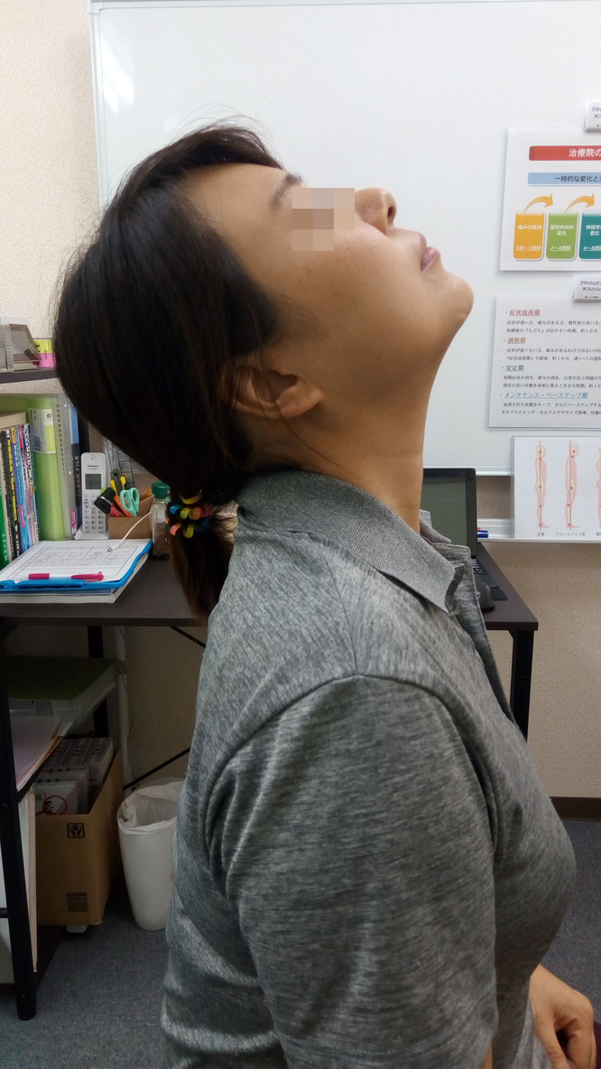首の痛み 肩の痛み 寝違え 治療後