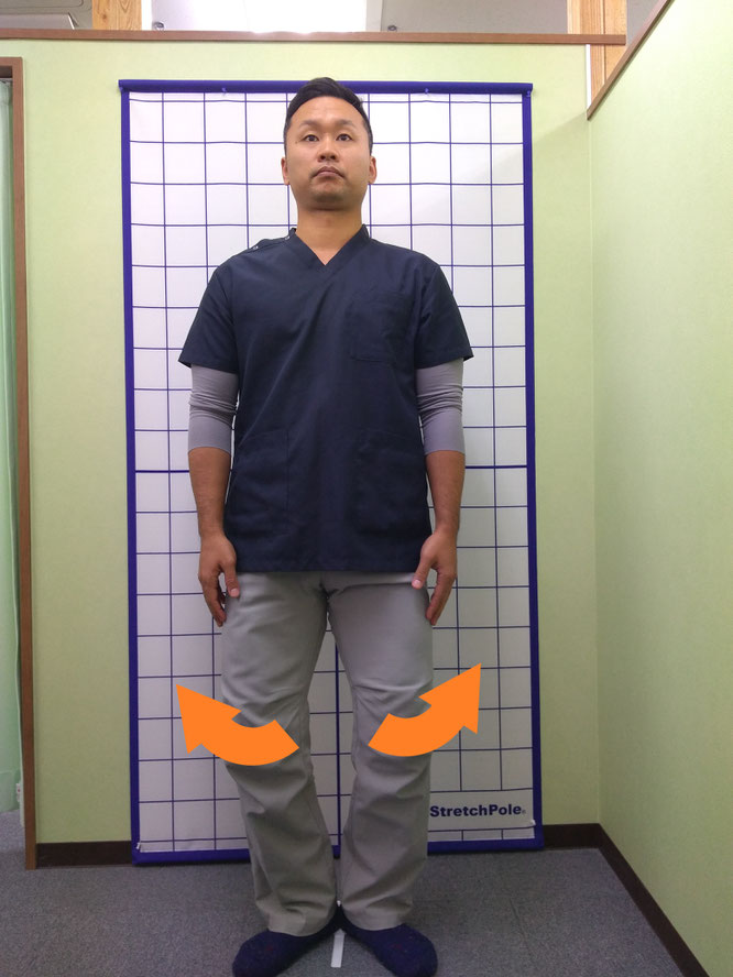 O脚患者さんの姿勢検査