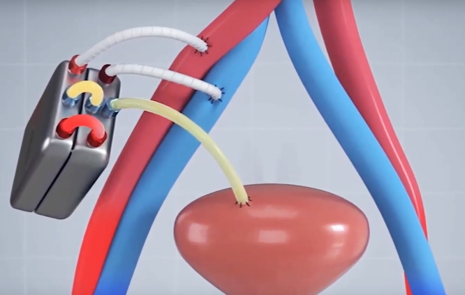Bildquelle: https://www.kidneyx.org/about-kidneyx/