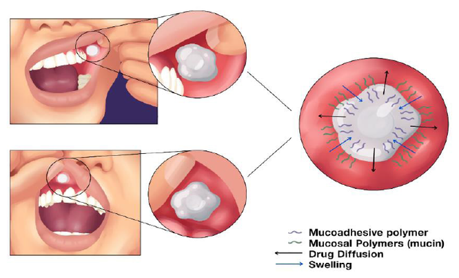 Mucuadhesive polymer for buccal tablets