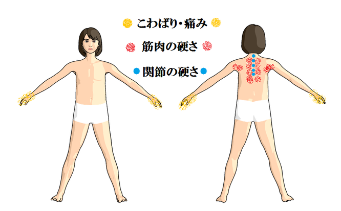 症状の図