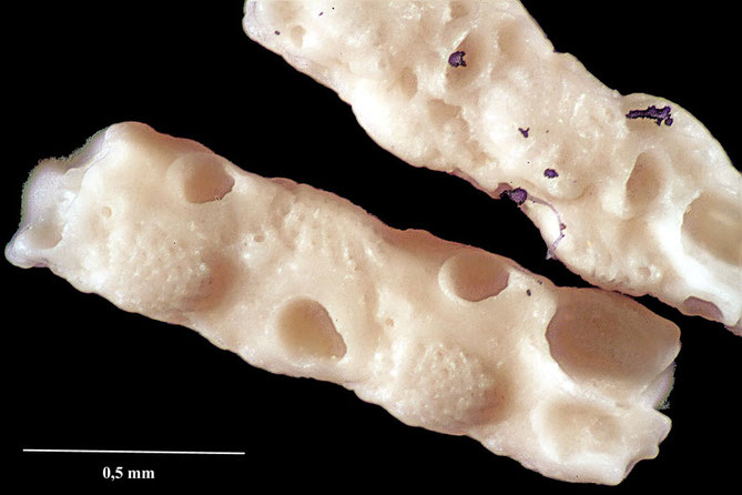 Senckenberg, Bryozoa, Bryozoen, Moostierchen, Sammlung Voigt