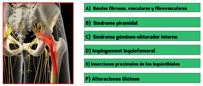 Síndrome del piramidal o Síndrome del glúteo profundo o subglúteo